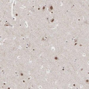 Anti-AUTS2 antibody produced in rabbit 