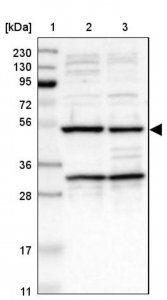 Anti-AVEN antibody produced in rabbit 