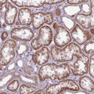 Anti-AVL9 antibody produced in rabbit 