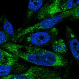 Anti-AVL9 antibody produced in rabbit 