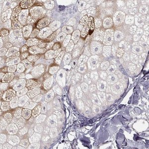 Anti-AWAT1 antibody produced in rabbit 