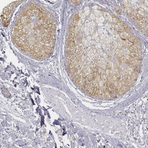 Anti-AWAT2 antibody produced in rabbit 