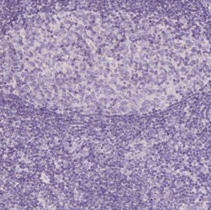Anti-AWAT2 antibody produced in rabbit 