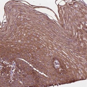 Anti-B3GALNT2 antibody produced in rabbit 