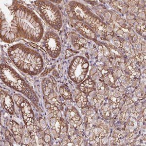 Anti-B3GALT5 antibody produced in rabbit 