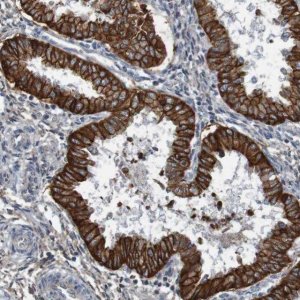 Anti-B3GAT2 antibody produced in rabbit 