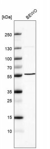 Anti-B3GNT2 antibody produced in rabbit HPA005997-100UL