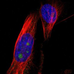 Anti-B3GNT5 antibody produced in rabbit 