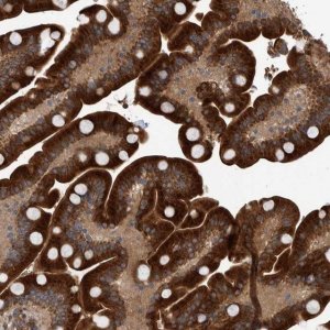 Anti-B3GNTL1 antibody produced in rabbit 