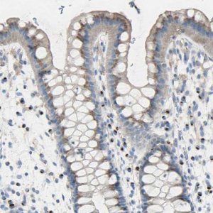 Anti-B4GALT3 antibody produced in rabbit 