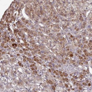 Anti-B4GALT6 antibody produced in rabbit 