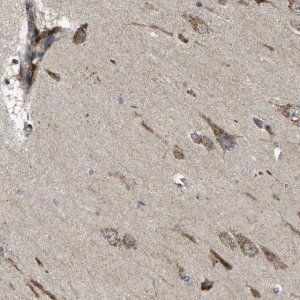 Anti-B4GAT1 antibody produced in rabbit 