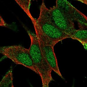 Anti-BAALC antibody produced in rabbit 