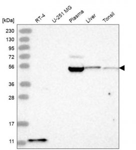 Anti-BACE2 antibody produced in rabbit 