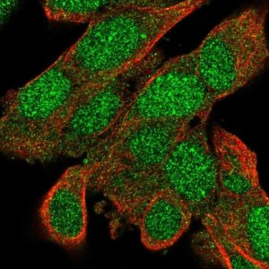 Anti-BACH2 antibody produced in rabbit 