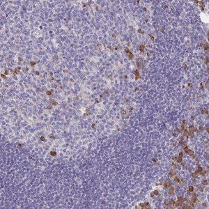 Anti-BAD antibody produced in rabbit 