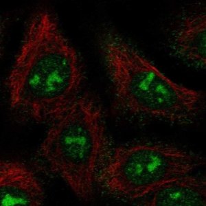 Anti-BAHCC1 antibody produced in rabbit 