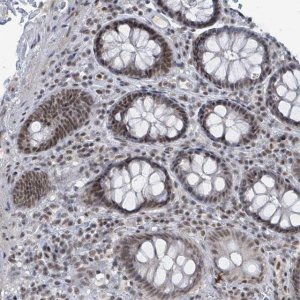 Anti-BANP antibody produced in rabbit 
