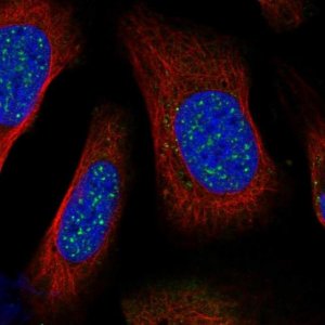 Anti-BARD1 antibody produced in rabbit 