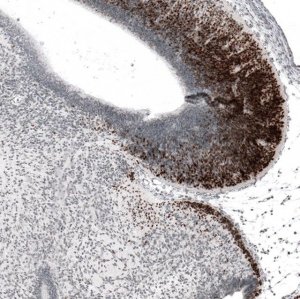 Anti-BARHL1 antibody produced in rabbit 