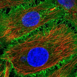 Anti-BASP1 antibody produced in rabbit 
