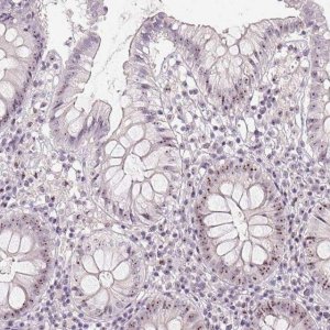 Anti-BATF2 antibody produced in rabbit 