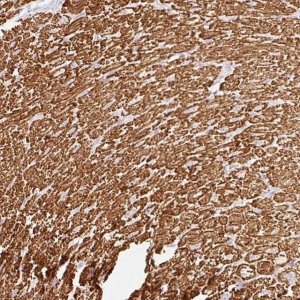 Anti-BBIP1 antibody produced in rabbit 