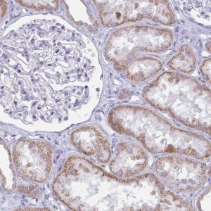 Anti-BBS1 antibody produced in rabbit 