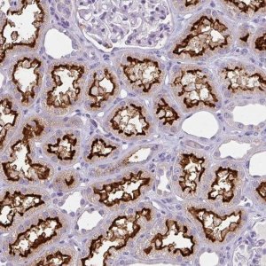 Anti-BBS12 antibody produced in rabbit 