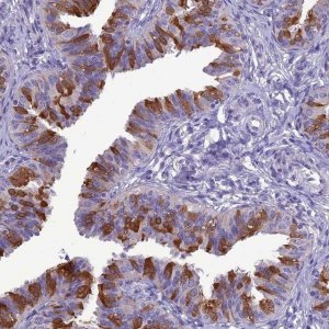 Anti-BBS2 antibody produced in rabbit 