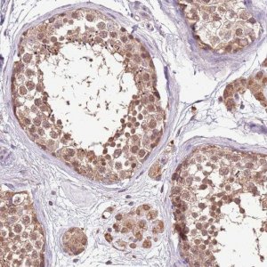 Anti-BBS5 antibody produced in rabbit 