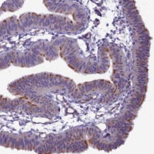 Anti-BBS7 antibody produced in rabbit 
