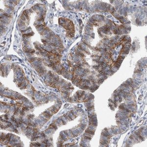 Anti-BCAM antibody produced in rabbit 