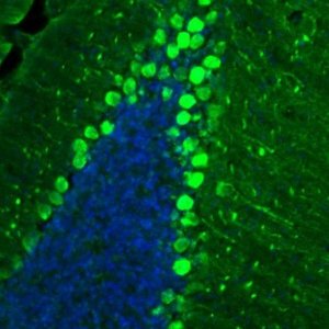 Anti-BCAR1 antibody produced in rabbit 