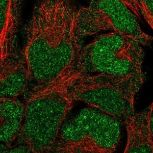 Anti-BCCIP antibody produced in rabbit 