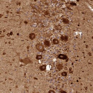 Anti-BCDIN3D antibody produced in rabbit 