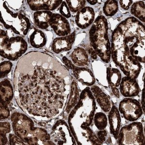 Anti-BCKDHA antibody produced in rabbit 