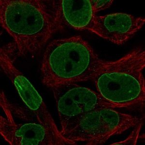 Anti-BCL2 antibody produced in rabbit 