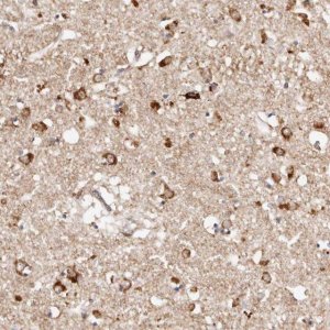 Anti-BCL2L15 antibody produced in rabbit 