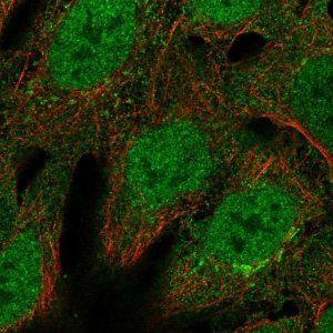 Anti-BCL6 antibody produced in rabbit 