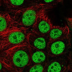 Anti-BCL7C antibody produced in rabbit 