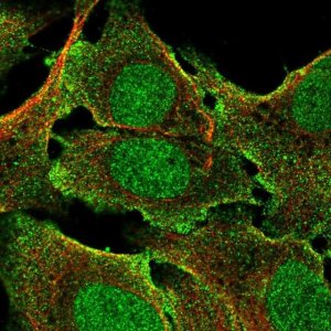 Anti-BCORL1 antibody produced in rabbit 