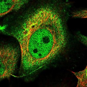 Anti-BCR antibody produced in rabbit 
