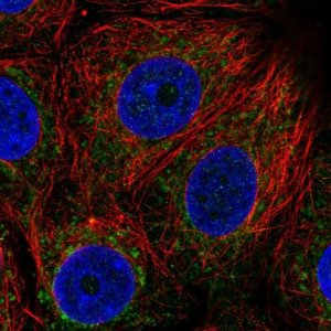 Anti-BDH1 antibody produced in rabbit 