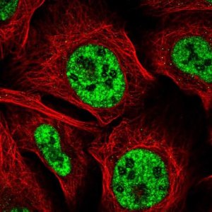 Anti-BDNF antibody produced in rabbit HPA056104-100UL