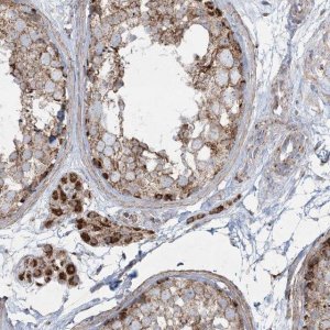 Anti-BEND4 antibody produced in rabbit 