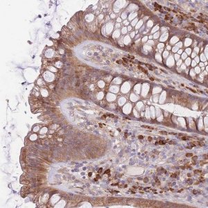 Anti-BEX2 antibody produced in rabbit 