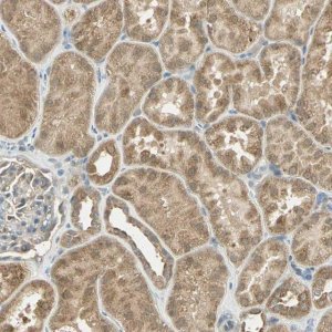 Anti-BIRC2 antibody produced in rabbit 