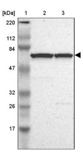 Anti-BIRC2 antibody produced in rabbit 