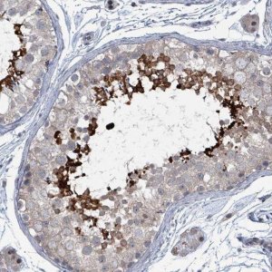 Anti-BIVM antibody produced in rabbit 